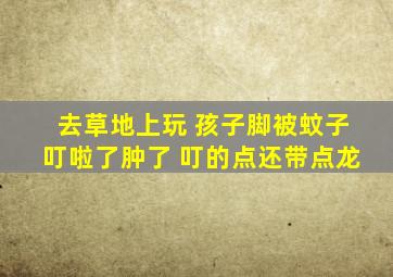 去草地上玩 孩子脚被蚊子叮啦了肿了 叮的点还带点龙